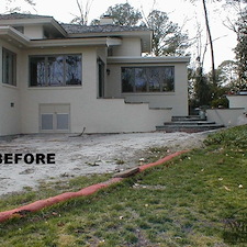 Before & After Photos 86